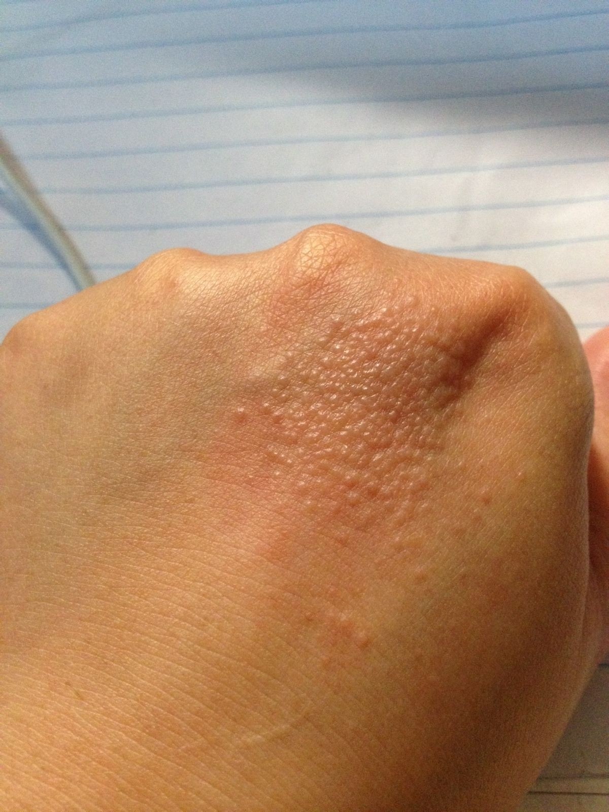 2024ƤԲѧҽʦ⡾⾫ѡ½⣫ģ⣫Ծ